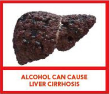 Cirrhotic liver label - © EuroCare