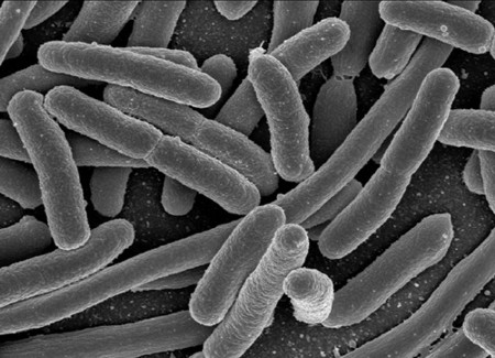 e_coli - © Rocky Mountain Laboratories