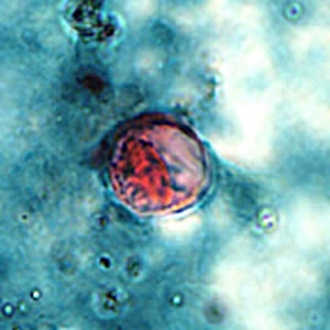 Cyclospora Oocyte - © cdc.gov