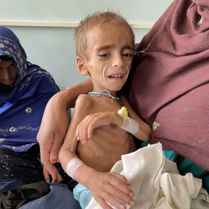 Starving Afghan Child - © Murteza Khaliqi - AFP