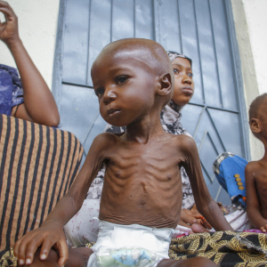 Starving Child - © 2026 AP Photo